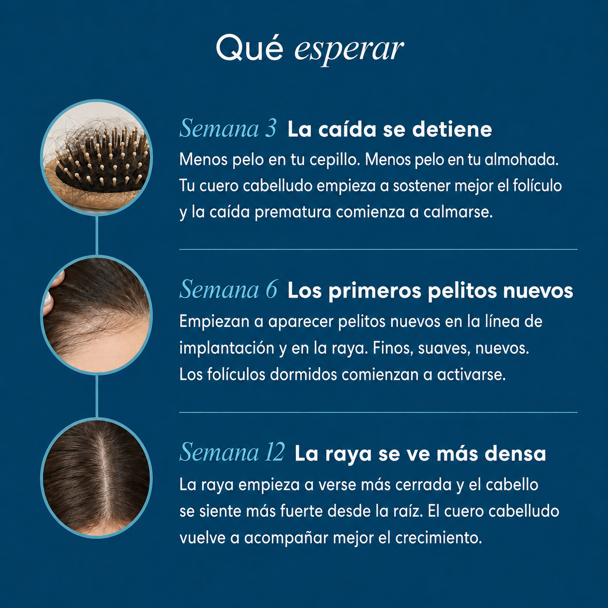 Kilbur™ Doble Acción - Sistema para detener caída en 6 semanas